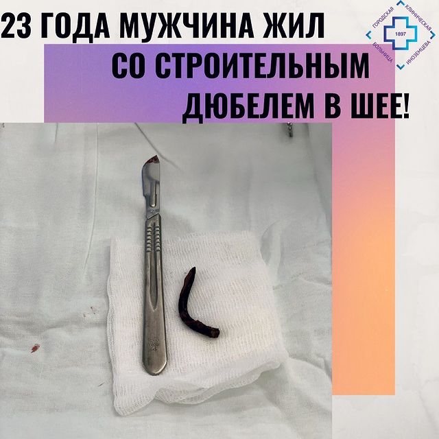 23 года мужчина жил со строительным дюбелем в шее!