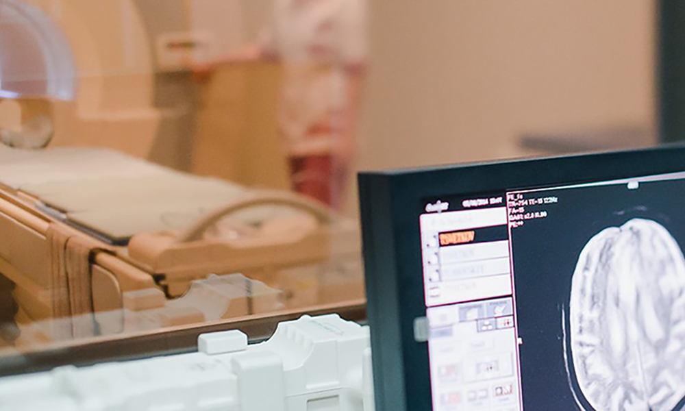 Московские врачи спасли пациентку с опухолями мозга, которые мешали ей говорить